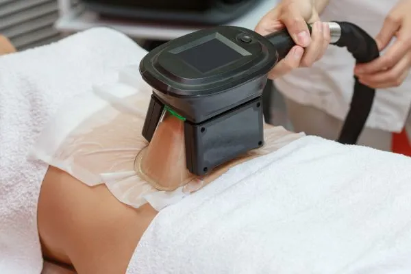 Image of person having fat freezing treatment to help weight gain Healey