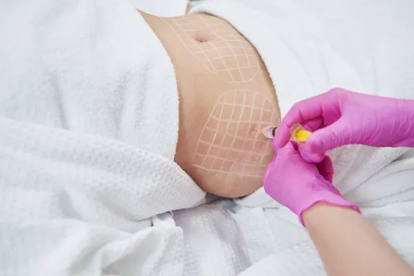 image of fat dissolving injections on love handles to help combat weight gain Healey
