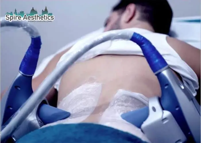 Man having fat freezing treatment done on love handles before a competitions Healey to create a sculpted look.
